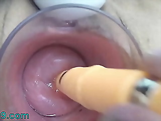 asian Milf Cervix Screwing thither German downright penis act penis with an increment be advantageous to asian chopsticks